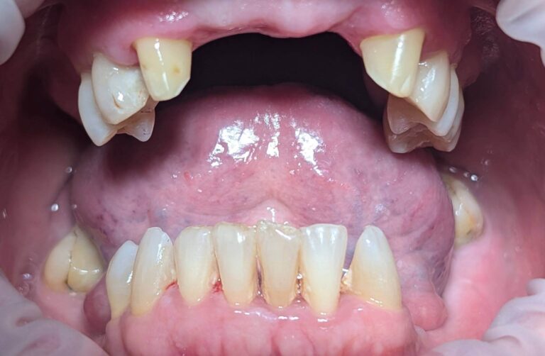 Metamorfoza 3 - przed