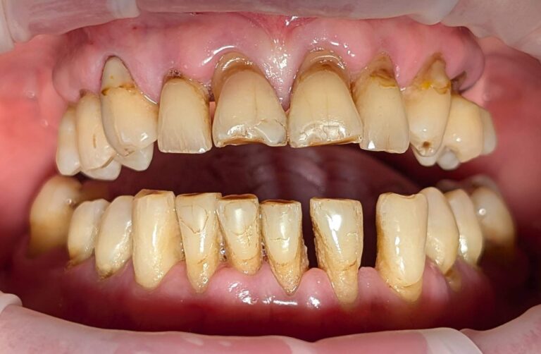 Metamorfoza 2 - przed