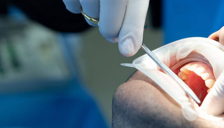 chirurgia stomatologiczna opoczno