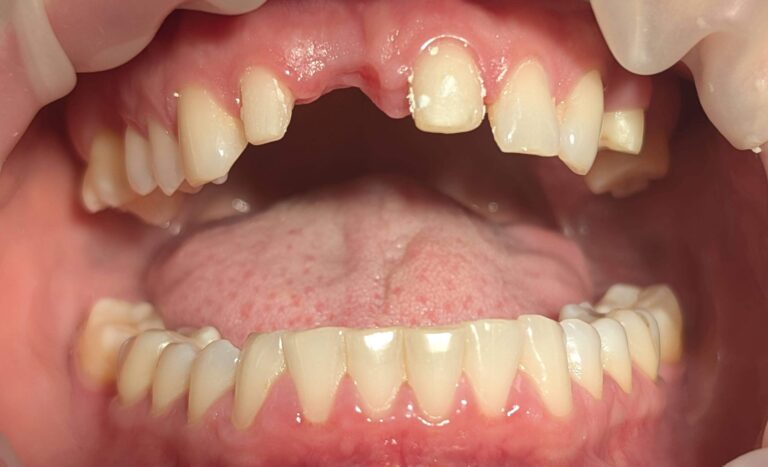 Metamorfoza 1 - przed